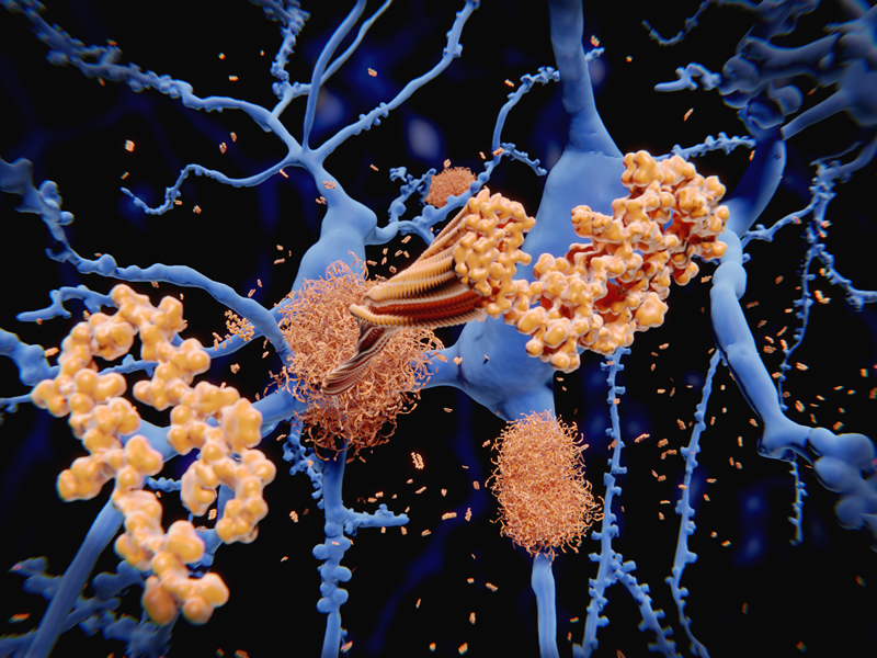 rare-diseases-101-systemic-amyloidosis-mendelian-co